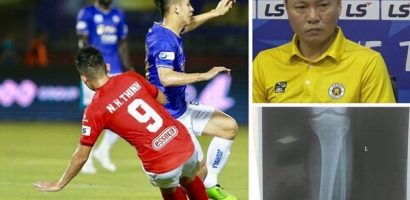 Đau đớn nhìn Hùng Dũng gãy chân, HLV Hà Nội tha thiết: ‘Xin đừng triệt hạ đồng nghiệp’