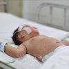 Thời gian ủ bệnh của người mắc sởi