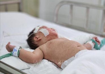 Thời gian ủ bệnh của người mắc sởi