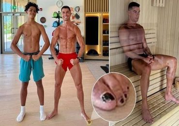 Sự thật ít ai ngờ đằng sau việc Ronaldo sơn đen móng chân