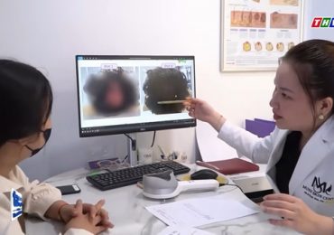 Lời Cảnh Báo: Nguy cơ từ dung dịch mọc tóc không rõ nguồn gốc được bán trên mạng