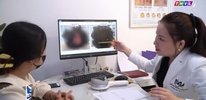 Lời Cảnh Báo: Nguy cơ từ dung dịch mọc tóc không rõ nguồn gốc được bán trên mạng