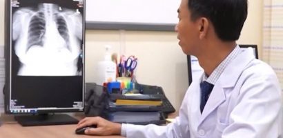 Lời Cảnh Báo: Đừng xem nhẹ những cơn ho kéo dài